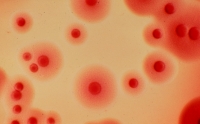 Nhiễm Chlamydia Nhiễm Chlamydia