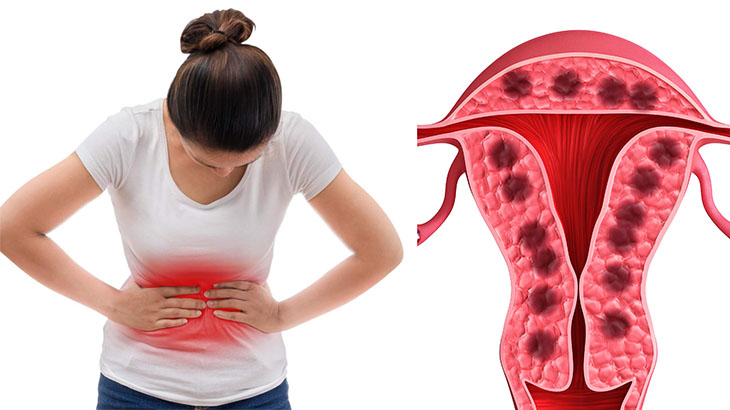 Chu kì kinh nguyệt đầu tiên: những điều cần biết Chu kì kinh nguyệt đầu tiên: những điều cần biết