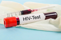 Dấu hiệu HIV ở nam: Phát hiện sớm tăng cơ hội điều trị Dấu hiệu HIV ở nam: Phát hiện sớm tăng cơ hội điều trị