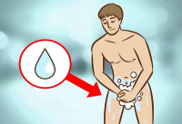 NAM GIỚI CẦN XỬ TRÍ RA SAO KHI BỊ VIÊM DƯƠNG VẬT? NAM GIỚI CẦN XỬ TRÍ RA SAO KHI BỊ VIÊM DƯƠNG VẬT?