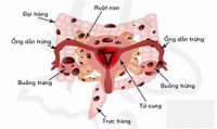 Buồng trứng - những điều cần biết