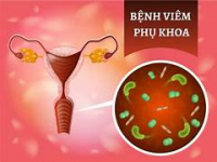 Bệnh phụ khoa: Dấu hiệu nhận biết và các bệnh thường gặp