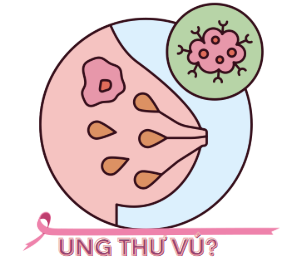 Tìm hiểu về UNG THƯ VÚ – Phần 1 Tìm hiểu về UNG THƯ VÚ – Phần 1