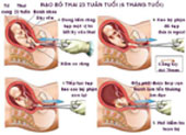 Các biện pháp phá thai 